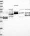 Tubulin Folding Cofactor E Like antibody, NBP1-89578, Novus Biologicals, Western Blot image 