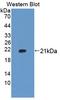 Ubiquitously Expressed Prefoldin Like Chaperone antibody, LS-C725762, Lifespan Biosciences, Western Blot image 