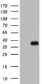 Ornithine Carbamoyltransferase antibody, CF802590, Origene, Western Blot image 