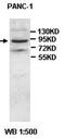 ATP-binding cassette sub-family B member 6, mitochondrial antibody, orb77653, Biorbyt, Western Blot image 