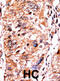 CDKN2A antibody, abx031883, Abbexa, Immunohistochemistry paraffin image 