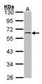 Ribosomal Protein S6 Kinase B2 antibody, GTX101886, GeneTex, Western Blot image 