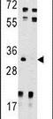 Uridine-Cytidine Kinase 2 antibody, PA5-14010, Invitrogen Antibodies, Western Blot image 
