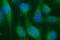 Scavenger Receptor Class B Member 1 antibody, MA5-26323, Invitrogen Antibodies, Immunocytochemistry image 