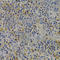 Insulin Like Growth Factor Binding Protein 1 antibody, A2981, ABclonal Technology, Immunohistochemistry paraffin image 