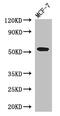 Presenilin 1 antibody, CSB-PA018846EA01HU, Cusabio, Western Blot image 