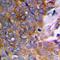 JunB Proto-Oncogene, AP-1 Transcription Factor Subunit antibody, orb256641, Biorbyt, Immunohistochemistry paraffin image 