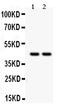 RUNX Family Transcription Factor 3 antibody, PB9432, Boster Biological Technology, Western Blot image 