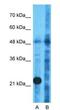 Tryptophanyl TRNA Synthetase 2, Mitochondrial antibody, NBP1-54653, Novus Biologicals, Western Blot image 