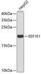 Eukaryotic Translation Elongation Factor 1 Epsilon 1 antibody, 19-338, ProSci, Western Blot image 