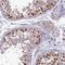 Testis-specific Y-encoded-like protein 2 antibody, NBP1-91787, Novus Biologicals, Immunohistochemistry frozen image 