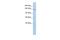 Transmembrane Protein 132B antibody, PA5-69678, Invitrogen Antibodies, Western Blot image 