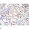 SMAD Family Member 4 antibody, LS-C812772, Lifespan Biosciences, Immunohistochemistry paraffin image 