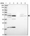 Zinc Finger Protein 766 antibody, NBP1-92643, Novus Biologicals, Western Blot image 