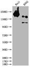 Inositol Polyphosphate-5-Phosphatase D antibody, CSB-RA157463A0HU, Cusabio, Western Blot image 