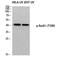 RAD51 Recombinase antibody, STJ91266, St John