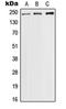 Sodium Voltage-Gated Channel Alpha Subunit 9 antibody, orb214559, Biorbyt, Western Blot image 