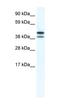 TATA-Box Binding Protein Like 2 antibody, orb324726, Biorbyt, Western Blot image 