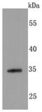 Syndecan 1 antibody, A00991, Boster Biological Technology, Western Blot image 