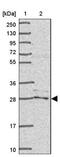 GatC-like protein antibody, NBP2-13385, Novus Biologicals, Western Blot image 