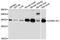 ATPase H+ Transporting V1 Subunit E1 antibody, A3756, ABclonal Technology, Western Blot image 