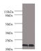 Chorionic Somatomammotropin Hormone 1 antibody, A57619-100, Epigentek, Western Blot image 