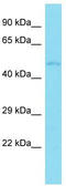 Adrenoceptor Alpha 2C antibody, TA342800, Origene, Western Blot image 