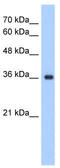 Elongation of very long chain fatty acids protein 7 antibody, TA338690, Origene, Western Blot image 