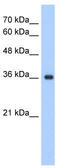 ELOVL Fatty Acid Elongase 7 antibody, TA338690, Origene, Western Blot image 