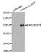 Keratin 8 antibody, MBS128454, MyBioSource, Western Blot image 