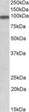 Adaptor Protein, Phosphotyrosine Interacting With PH Domain And Leucine Zipper 1 antibody, MBS423130, MyBioSource, Western Blot image 