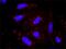 Protein Phosphatase, Mg2+/Mn2+ Dependent 1A antibody, H00005494-M03, Novus Biologicals, Proximity Ligation Assay image 