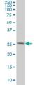 Pyrroline-5-Carboxylate Reductase 3 antibody, H00065263-M01, Novus Biologicals, Western Blot image 