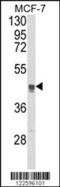 Trans-Golgi Network Protein 2 antibody, MBS9208301, MyBioSource, Western Blot image 