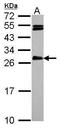 HAUS Augmin Like Complex Subunit 2 antibody, PA5-31250, Invitrogen Antibodies, Western Blot image 