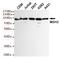 MutS Homolog 2 antibody, STJ99224, St John