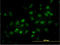 TRNA Aspartic Acid Methyltransferase 1 antibody, LS-C197067, Lifespan Biosciences, Immunofluorescence image 