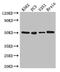 Tubulin Alpha 1c antibody, LS-C679921, Lifespan Biosciences, Western Blot image 