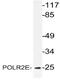 RNA Polymerase II Subunit E antibody, AP21061PU-N, Origene, Western Blot image 