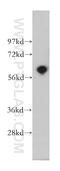 Calcium/calmodulin-dependent 3 ,5 -cyclic nucleotide phosphodiesterase 1A antibody, 12442-2-AP, Proteintech Group, Western Blot image 