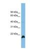 Peptidylprolyl Isomerase H antibody, NBP1-57630, Novus Biologicals, Western Blot image 