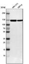 Complement Factor B antibody, NBP1-89985, Novus Biologicals, Western Blot image 