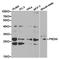 Peroxiredoxin 4 antibody, TA327054, Origene, Western Blot image 