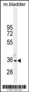 TGFB Induced Factor Homeobox 1 antibody, 56-206, ProSci, Western Blot image 