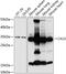 Carbonic Anhydrase 13 antibody, 15-557, ProSci, Western Blot image 