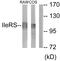 Isoleucyl-TRNA Synthetase 2, Mitochondrial antibody, GTX87187, GeneTex, Western Blot image 