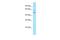 CWC27 Spliceosome Associated Cyclophilin antibody, A13346, Boster Biological Technology, Western Blot image 