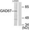 Glutamate Decarboxylase 1 antibody, TA311806, Origene, Western Blot image 