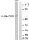 CD25 antibody, LS-C117961, Lifespan Biosciences, Western Blot image 