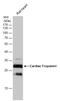 Troponin I3, Cardiac Type antibody, GTX112770, GeneTex, Western Blot image 